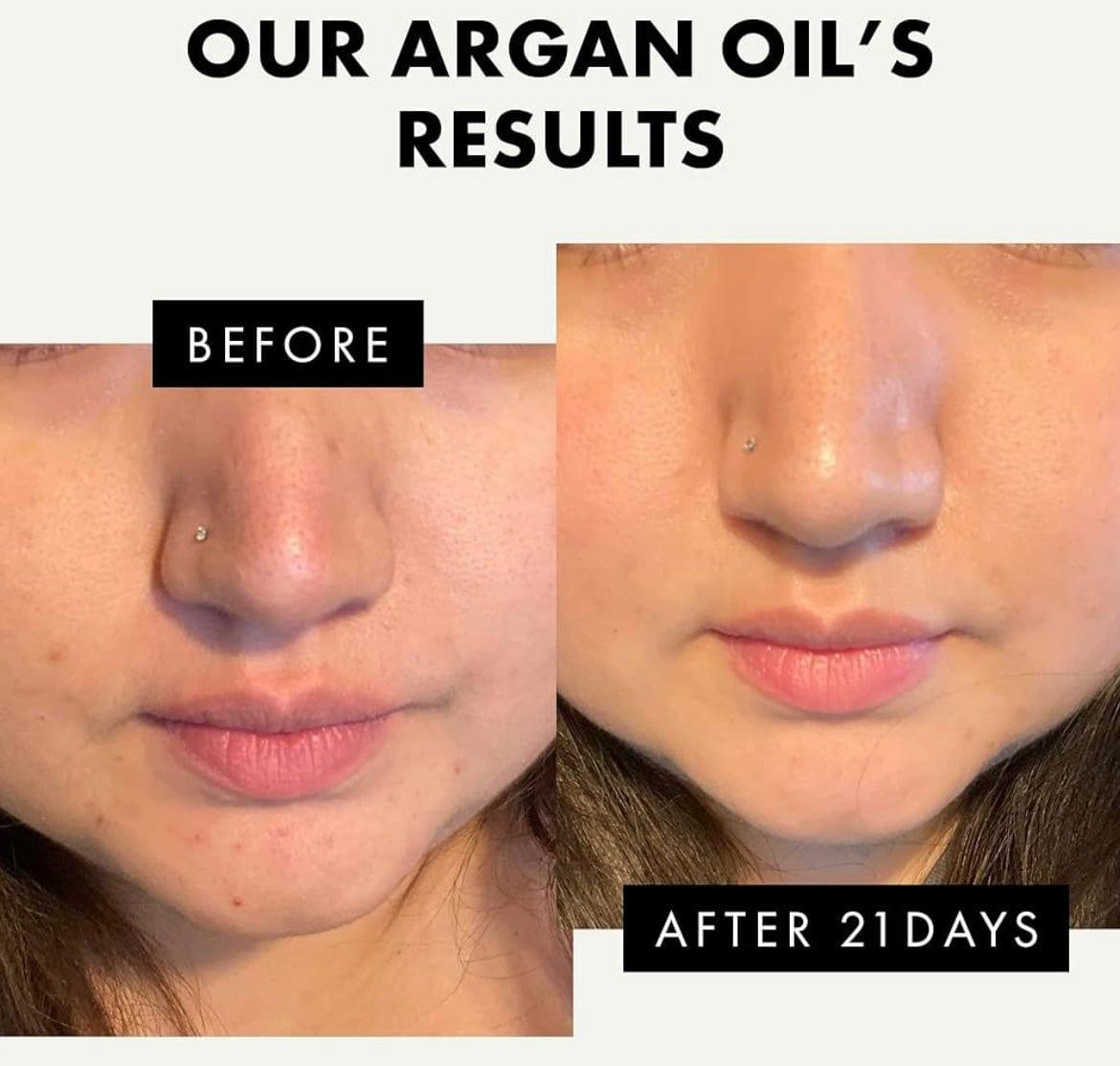 Aceite de argán rejuvenecedor de cabello y piel